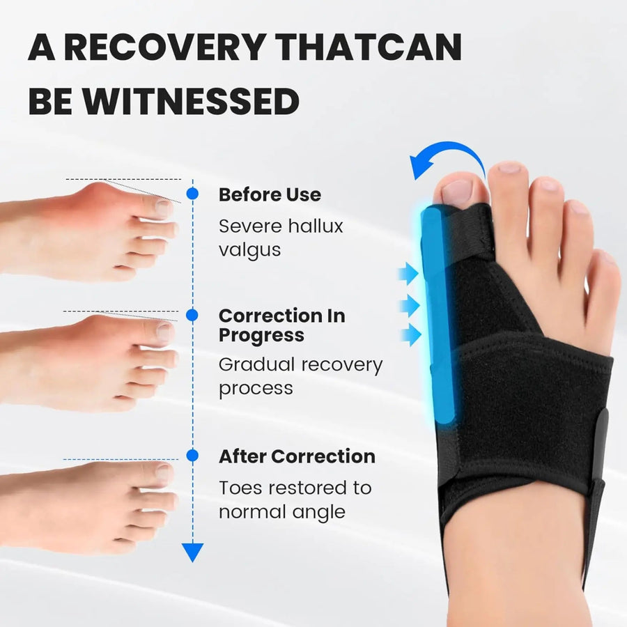 Sleepwyn Bunion Corrector for Big Toe Straightener (2pcs)